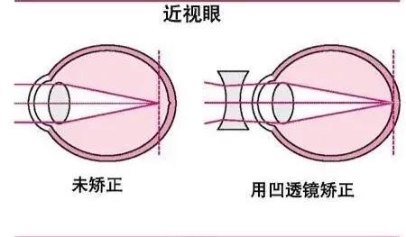 凸透镜成像原理,凸透镜成像原理公式