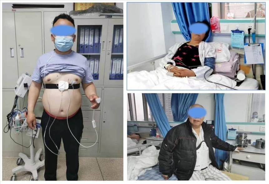 夜间打鼾呼吸暂停上百次 治疗三个月症状得以缓解