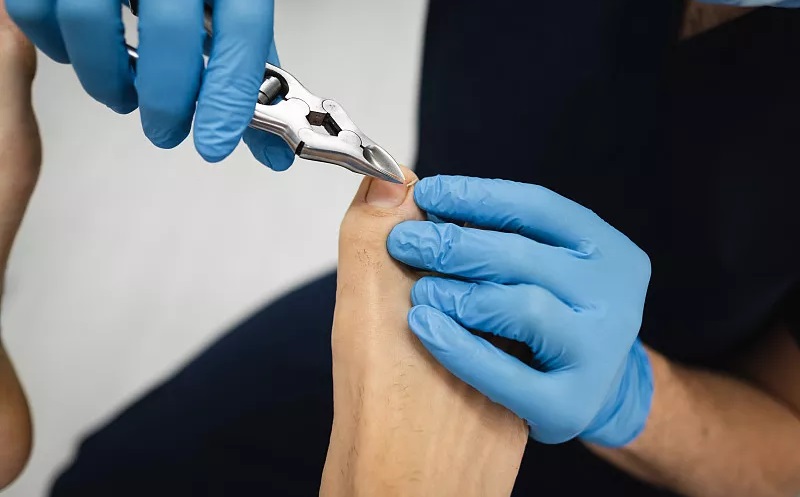 血糖高了，看脚就知道？脚部如果有这3种变化，提醒你该降糖了