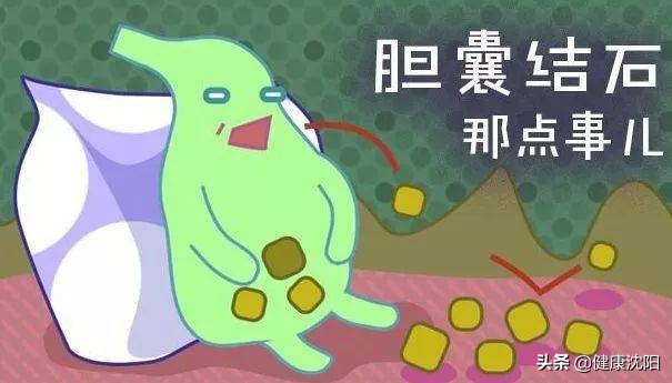 把健康帶回家 | 得了膽囊結石怎么办？