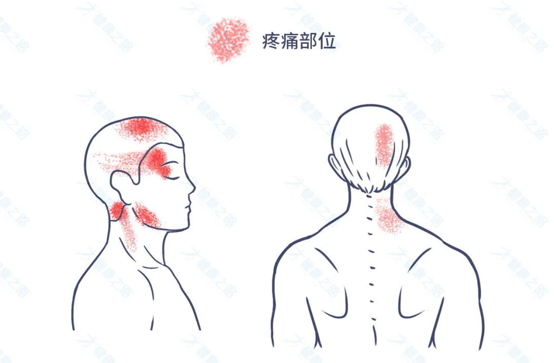 1个马上缓解头痛的方法,简单有效,还能预防颈椎病