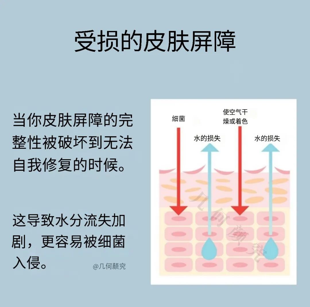 皮肤屏障功能｜受损的皮肤屏障该如何修复？