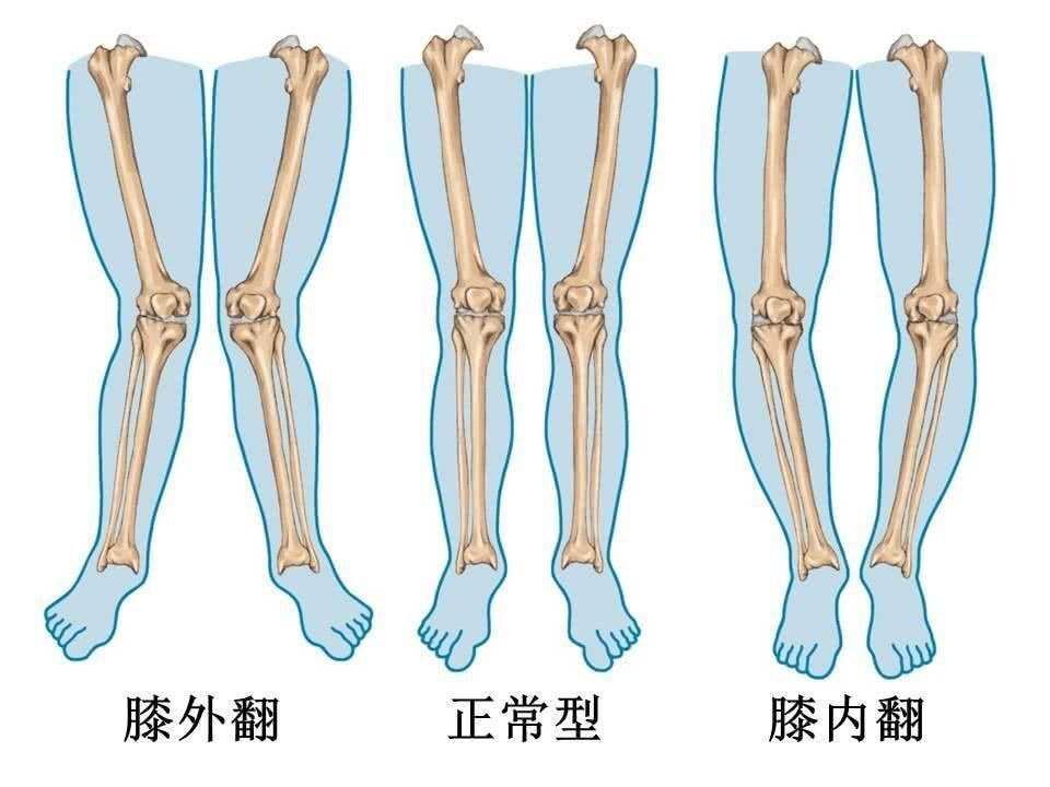 给新生儿绑腿的原因或许老人想错了，怎样让宝宝腿型漂亮，要记牢