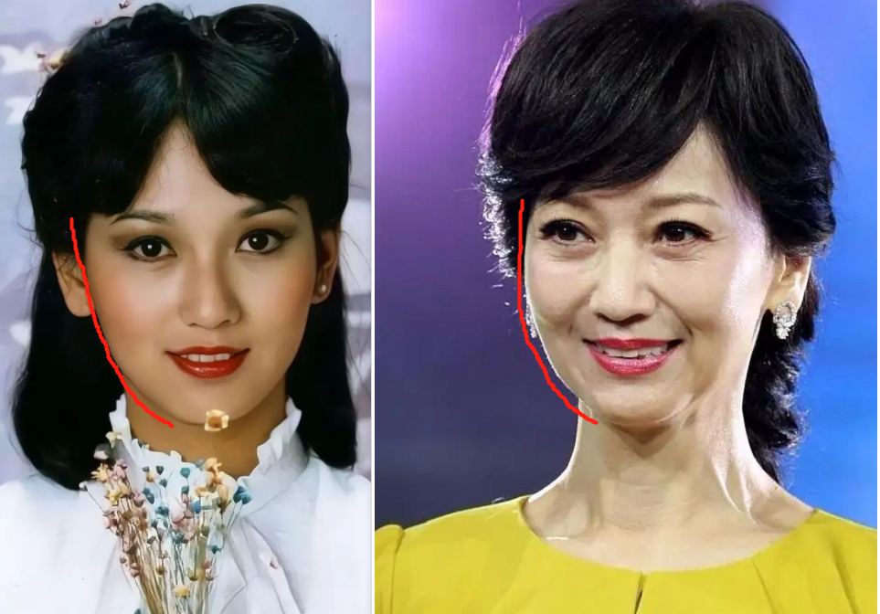 别再说高颧骨、方下颌抗老了！真正耐老的脸，得具备这3个条件