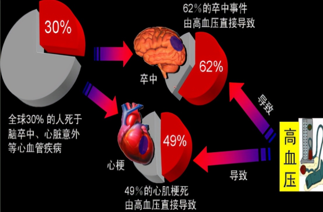 高血压伴同型半胱氨酸升高，脑梗风险可能会更高，补充叶酸有讲究
