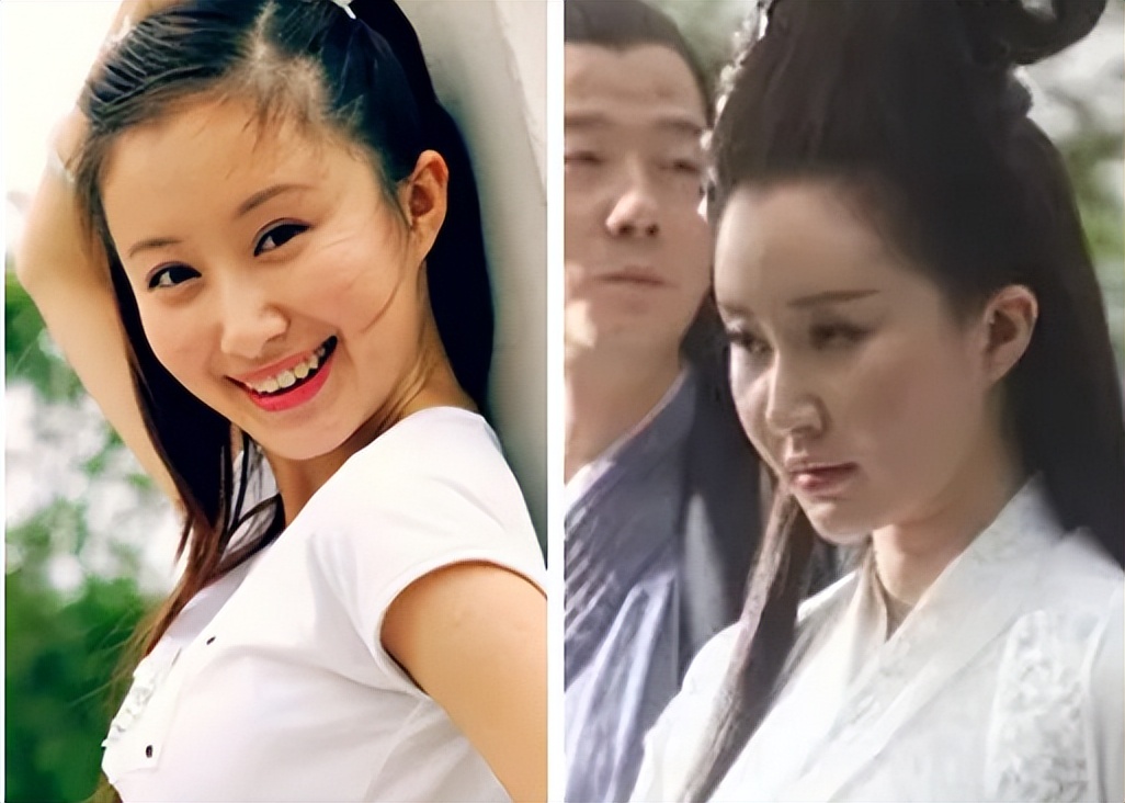 颜值忽高忽低、脸部时好时坏，这些灵动的女明星，都被医美坑惨了