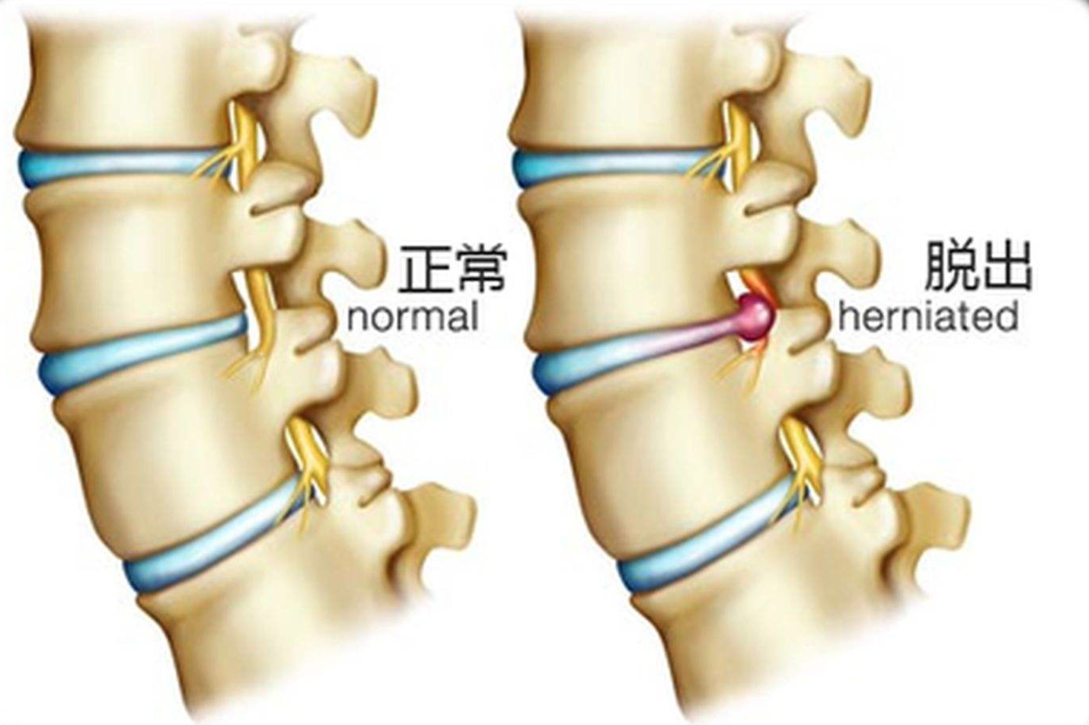 甲钴胺片是营养神经的“扛把子”，吃多久能停药？医生告诉你