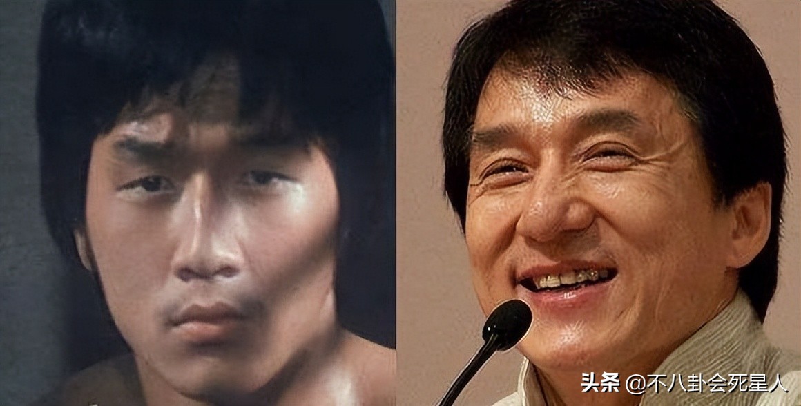 基因骗不了人！5位明星动脸“改命”，孩子却跟他们整容前一样