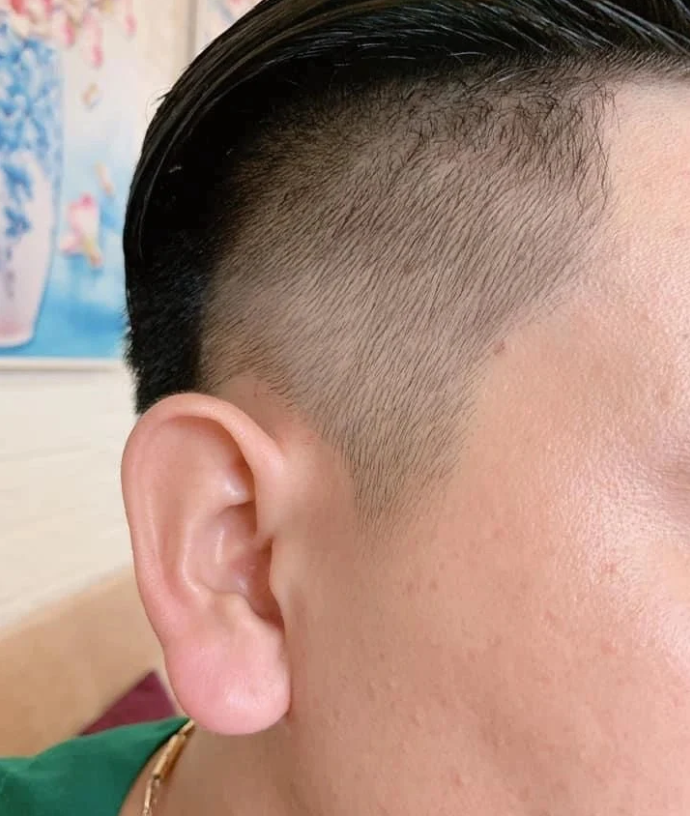 越南中年男人掀起佛耳整容潮，打造佛耳来招财
