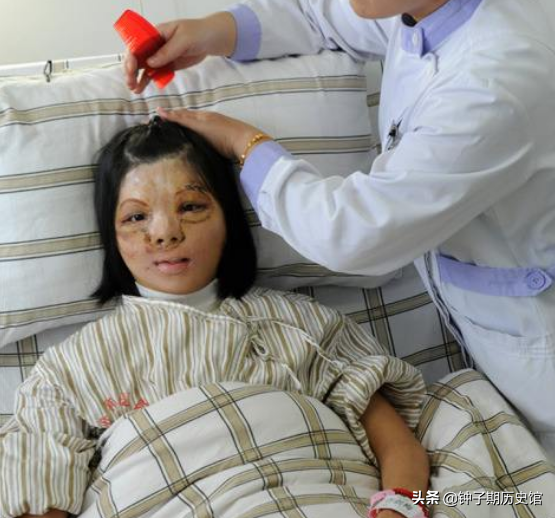 2013年，医生为少女换脸，从被人嫌弃到光彩照人，堪称最强整容术