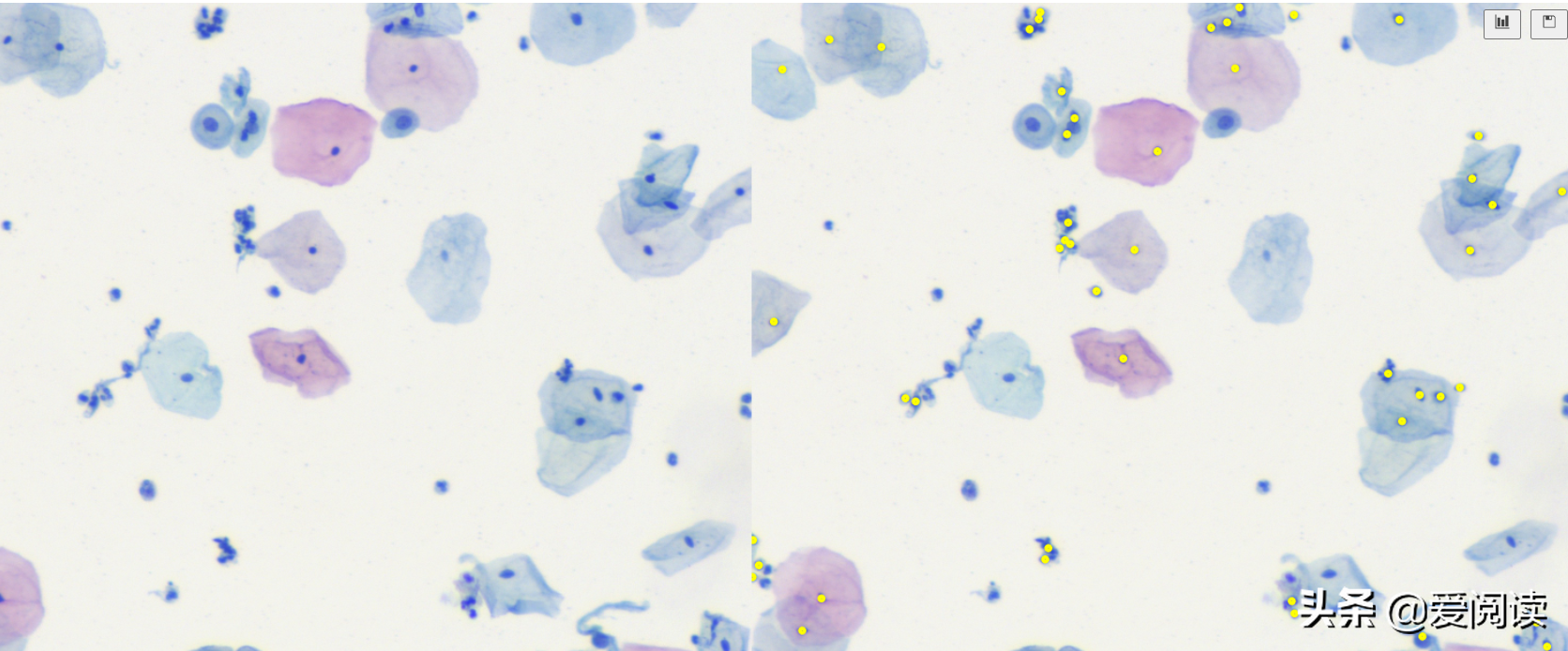 你试过吗？图像（细胞）分割