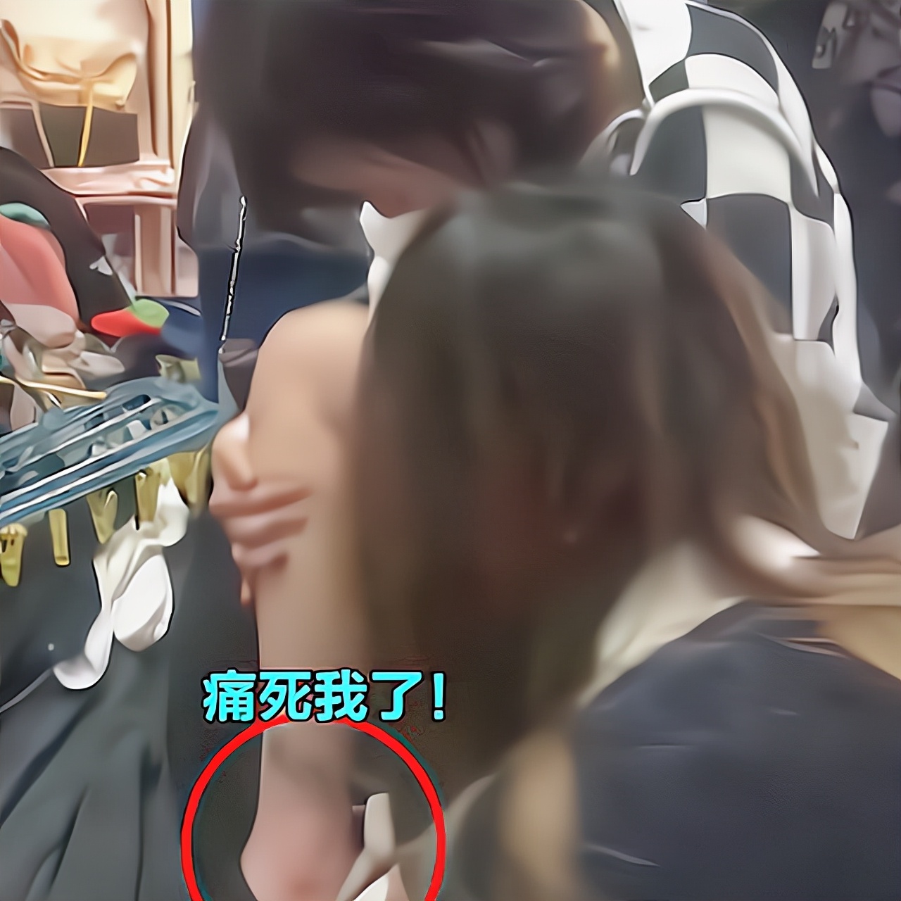 福建女大学生换衣服被蜇伤，舍友看着都心疼，腿上的纹身引争议