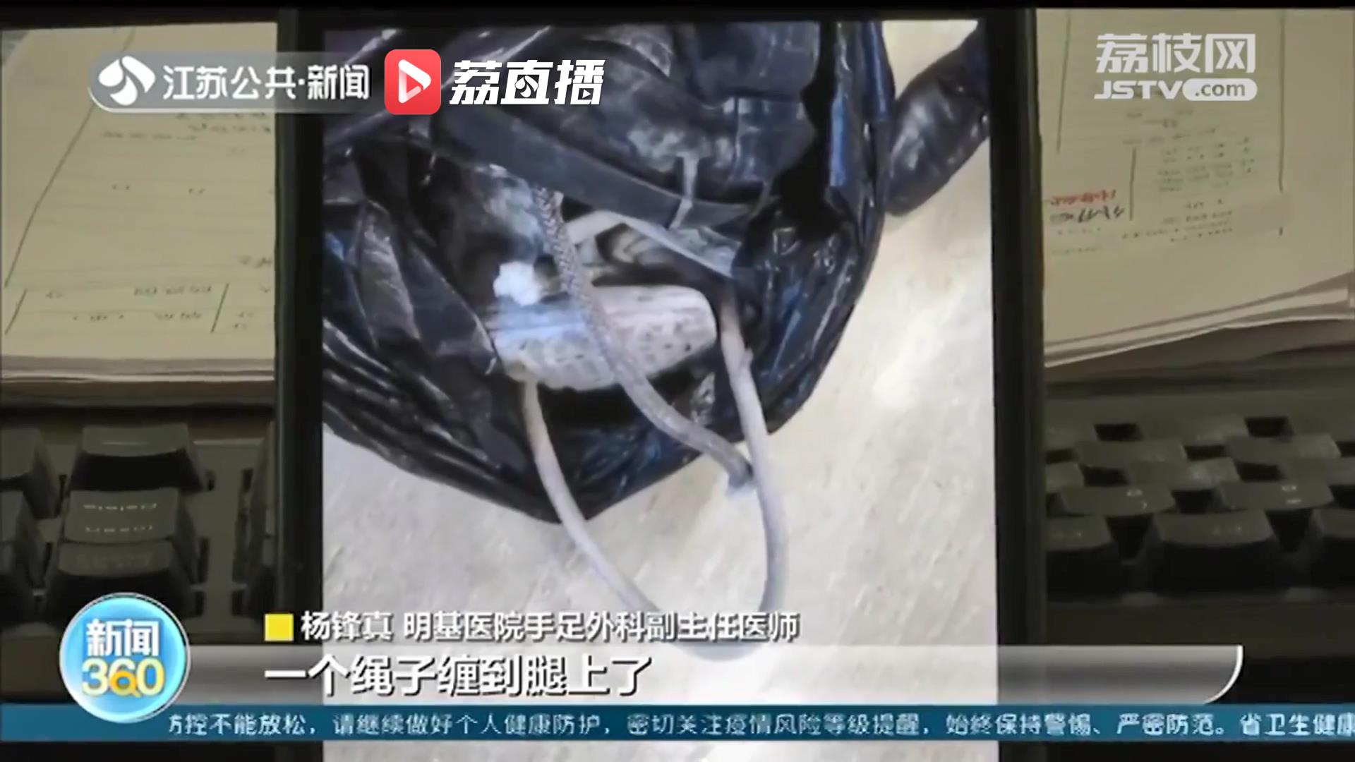 保住了！男子高空作业小腿不慎被勒断 医院全力救治再植成活