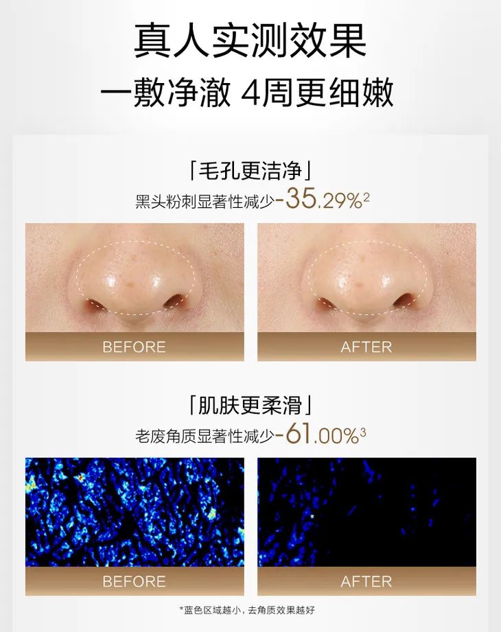 这个让毛孔越撑越大的行为，你总是下意识在做......