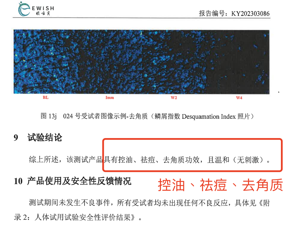 这个让毛孔越撑越大的行为，你总是下意识在做......