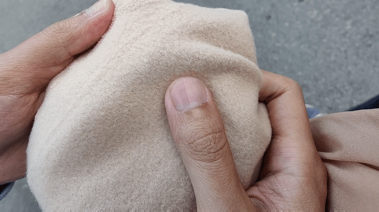 零下10℃也不怕的“光腿神器”