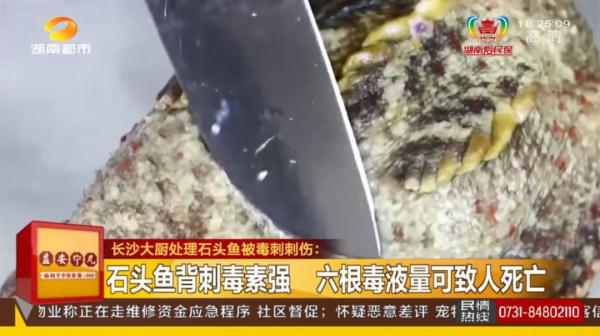 被鱼刺扎一下，长沙男子紧急送医！医生：这种鱼刺6根可致死