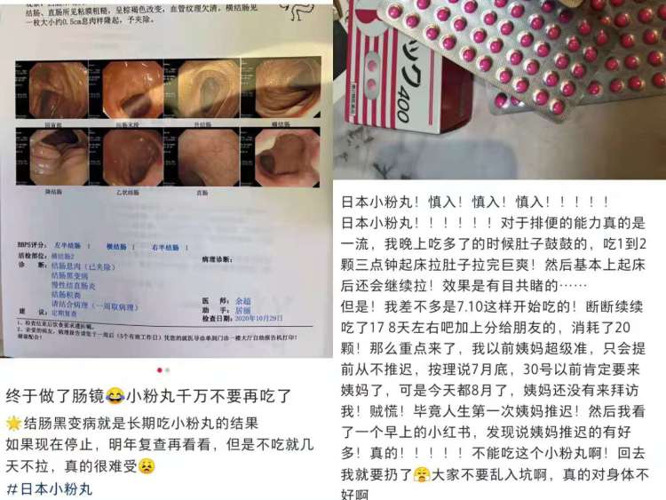 27岁姑娘每天狂吞100粒网红“小粉丸”，结肠如同松垮的热水袋！腹内积粪3公斤……