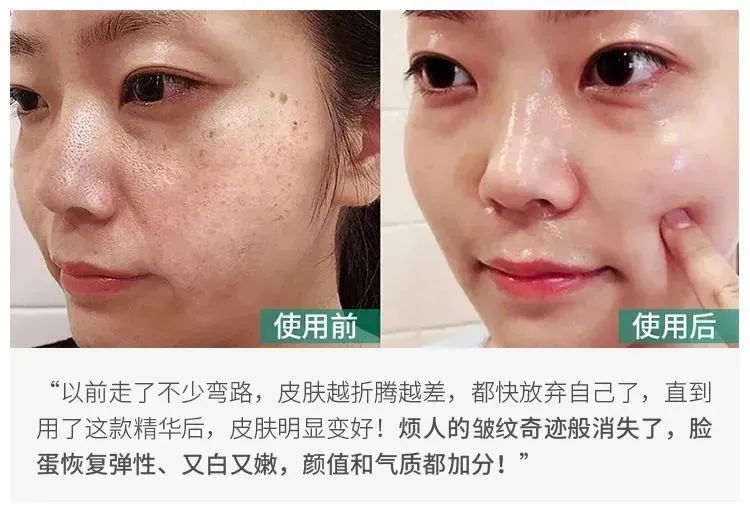 采用国际标准,采用国际标准管理办法