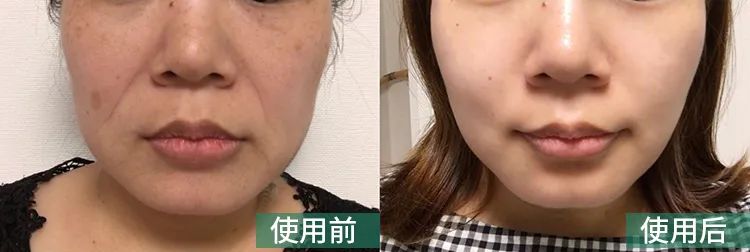 采用国际标准,采用国际标准管理办法