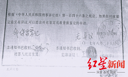 轻伤鉴定,轻伤鉴定标准
