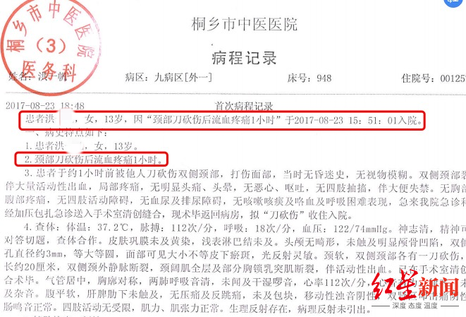 轻伤鉴定,轻伤鉴定标准