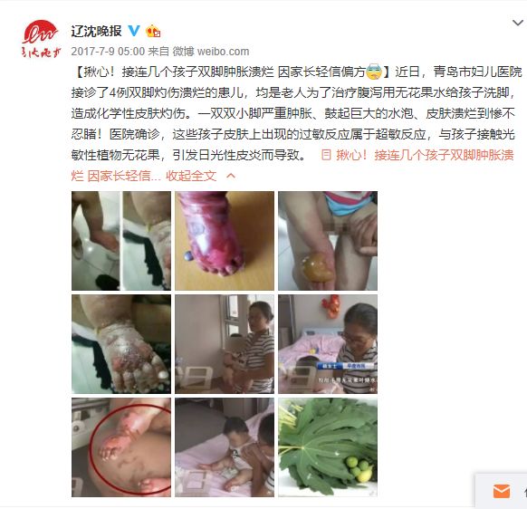 亲妈灌下半碗开水，孩子嘴巴全烫烂！这些匪夷所思的“急救秘方”，到底害了几条命