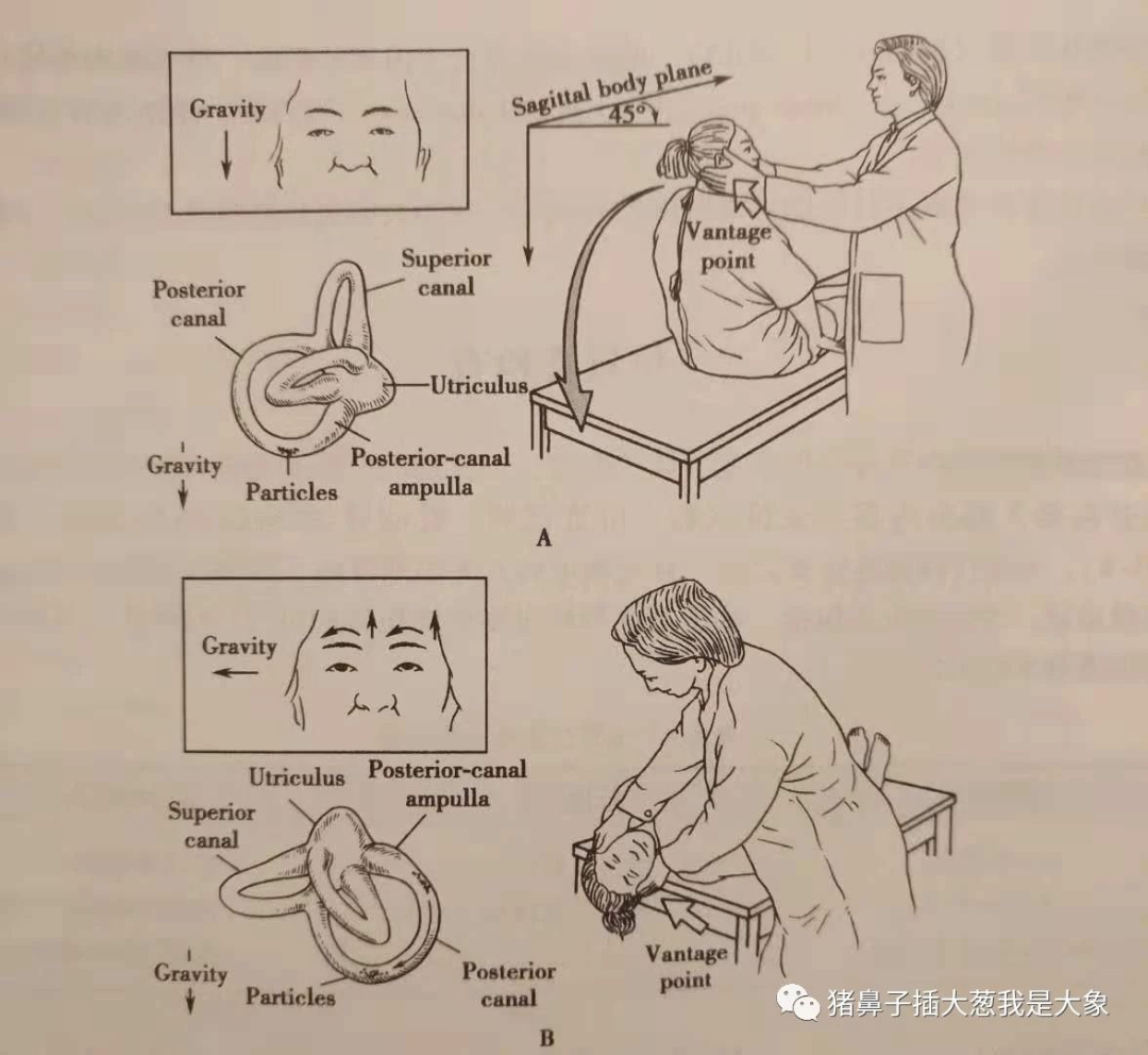 认识“耳石症”，摆脱一言不合就“晕”起来的苦恼