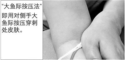 抽血后胳膊一片青是血管細？多半是你沒壓對