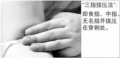 抽血后胳膊一片青是血管細？多半是你沒壓對