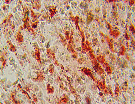 人间充质干细胞:3d微载体大规模扩增工艺概述