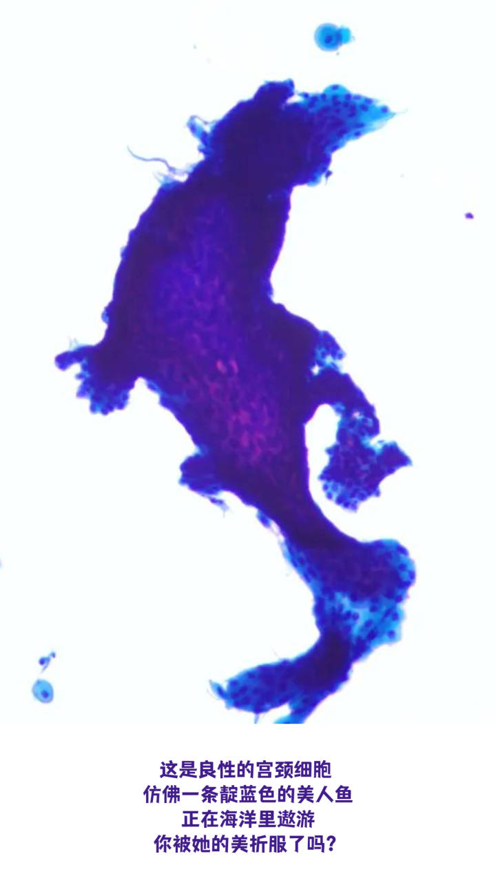 惊艳！显微镜下的人体细胞原来这么美