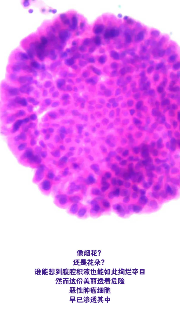 惊艳！显微镜下的人体细胞原来这么美