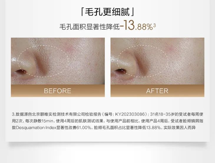 这个让毛孔越撑越大的行为，你总是下意识在做......