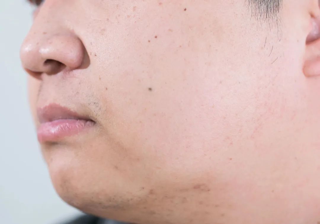 这个让毛孔越撑越大的行为，你总是下意识在做......