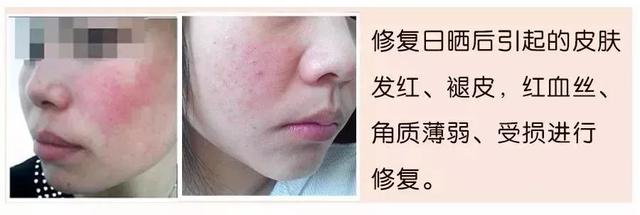 冻干粉用在护肤的哪个步骤，冻干粉免洗面膜效果怎么样（冻干粉是什么，有什么作用）