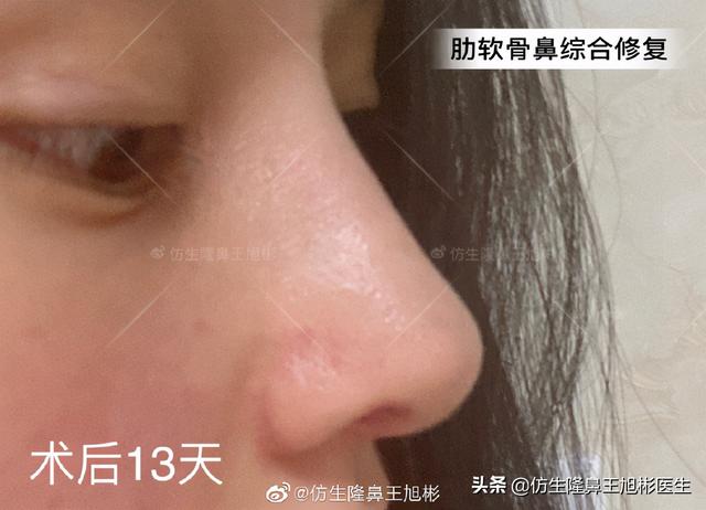 高级脸是什么意思，6种脸型不显老（“月亮脸”逆袭“高级脸”的不二法则是）