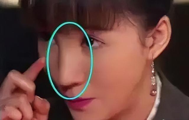 鼻头鼻翼整容(鼻整形怎么做选择) - 用户投稿 - 旭辉网