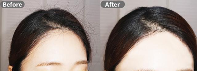 头发碎发多炸毛怎么办，头发碎发多炸毛怎么办用什么洗发水（头发有这4个特征的女人要注意了）