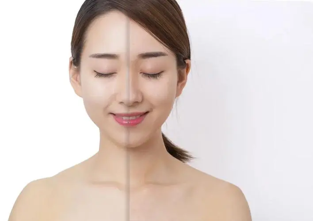 脸部快速美白， 美白的最有效方法（如何脸部美白）