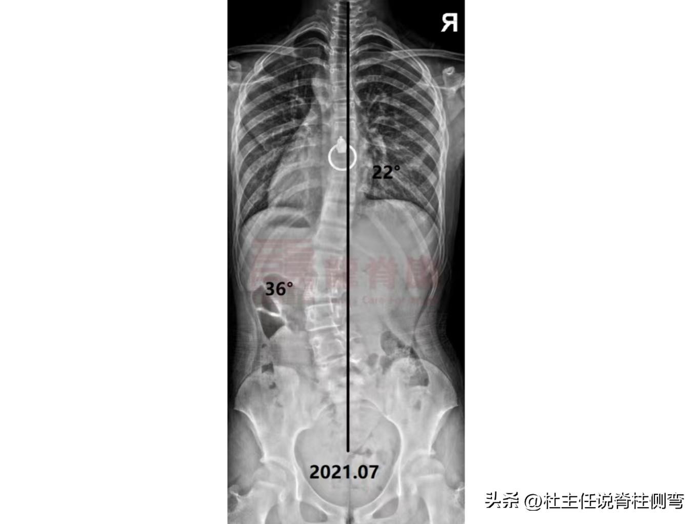 运康（令人欣喜）