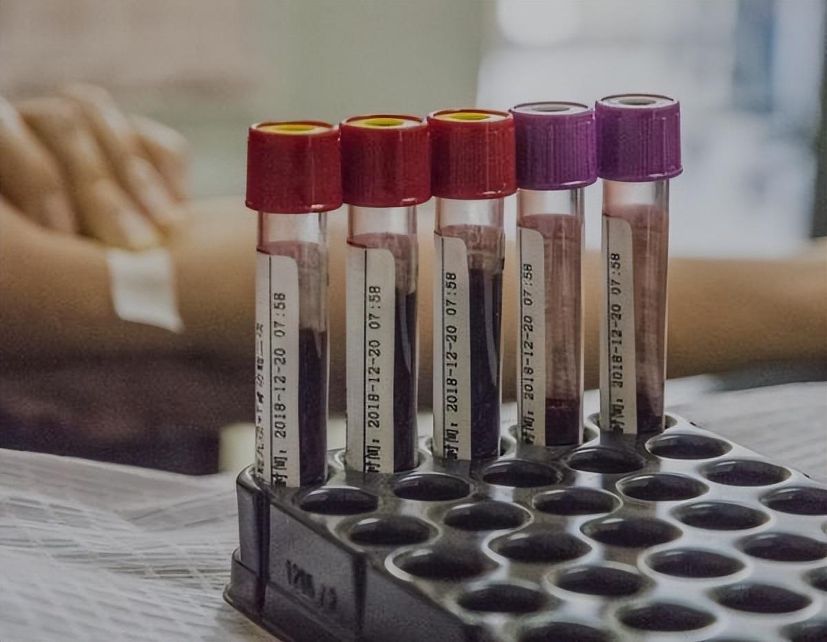 为什么一到医院看病,总是要抽血化验?