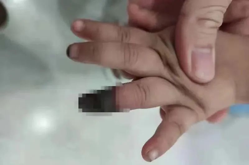 家庭常见用品危害大，这个东西别再用错了！